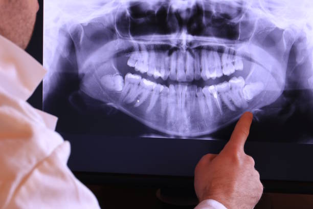 Best Emergency Dental Care for Abscessed Tooth in Locust Fork, AL