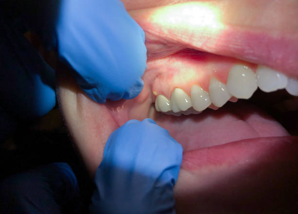 Best Emergency Dental Services for Seniors in Locust Fork, AL